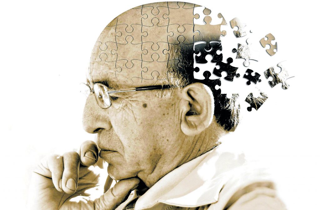 Illustration de la maladie d'Alzheimer